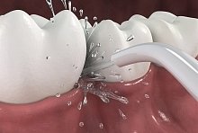 Орошения десен, отдых все включено №2